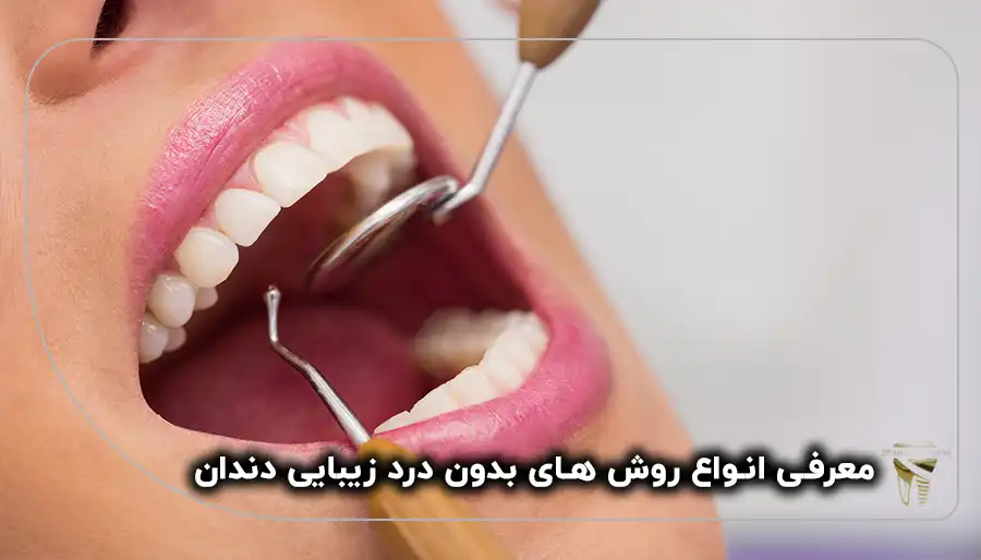 روش های بدون درد زیبایی دندان
