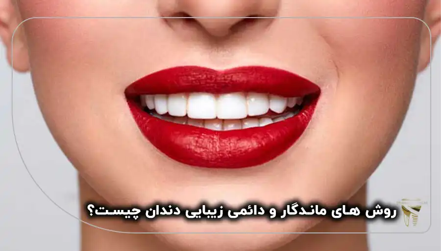 روش های دائمی زیبایی دندان