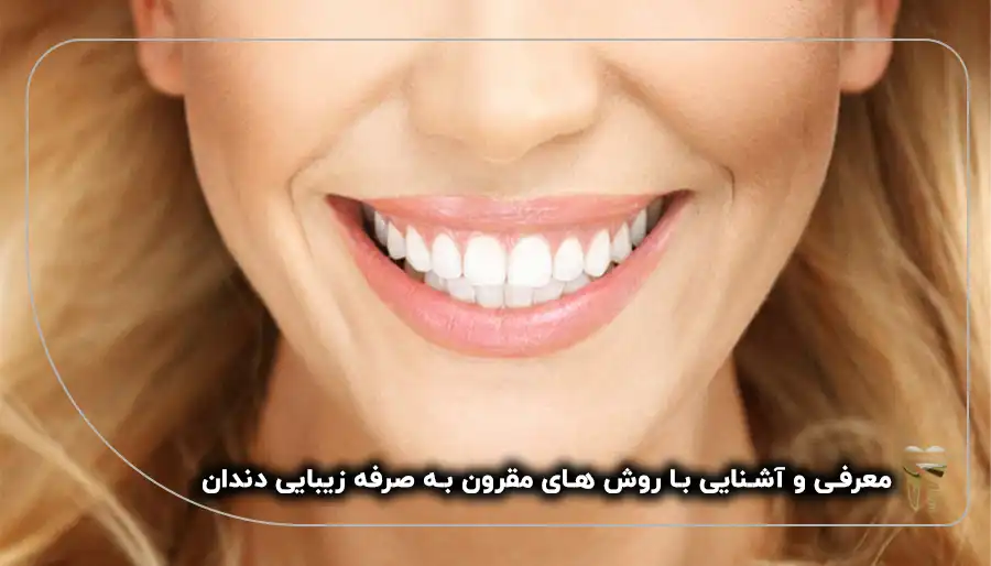 روش های مقرون به صرفه زیبایی دندان