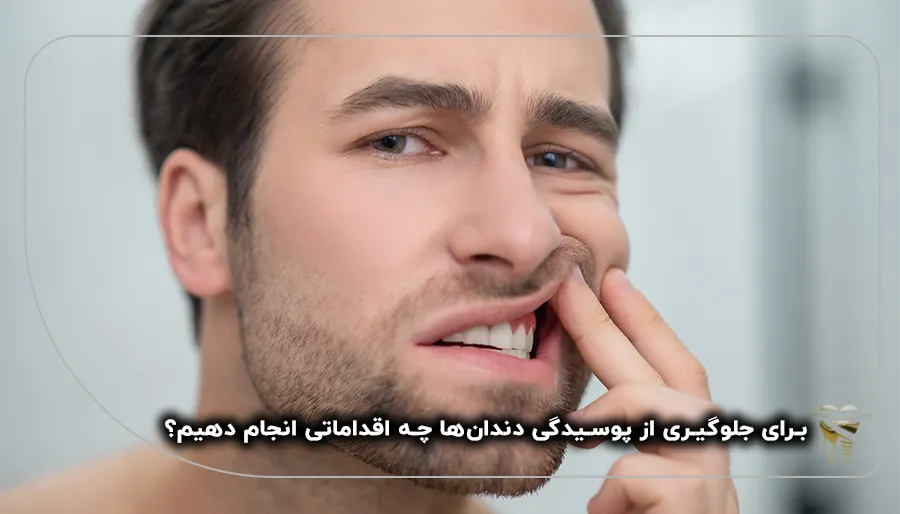 جلوگیری از پوسیدگی دندان‌