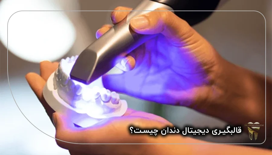 قالب گیری دیجیتال دندان چیست؟