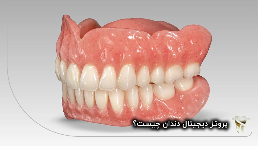پروتز دیجیتال دندان چیست