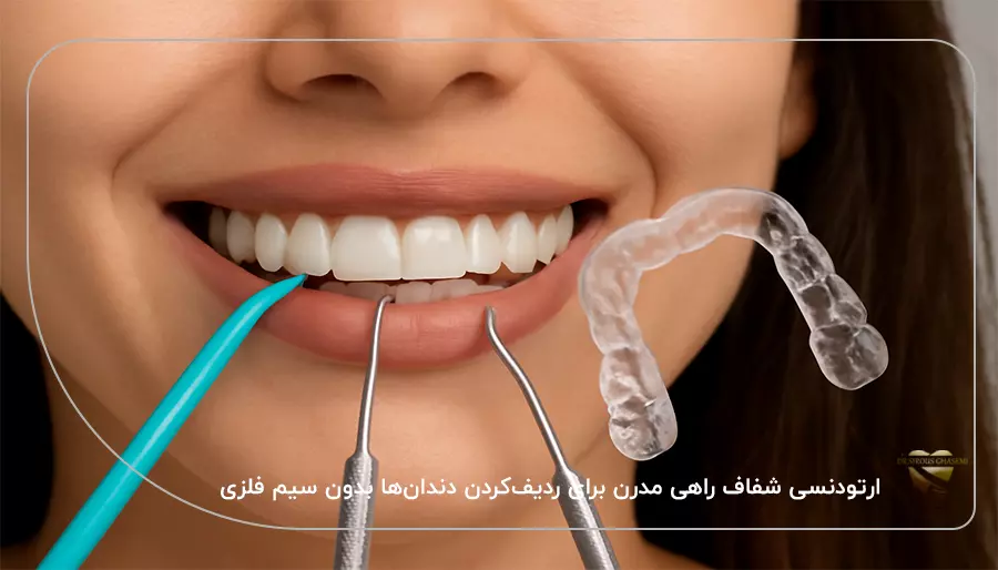 ارتودنسی شفاف راهی مدرن برای ردیف‌کردن دندان‌ها بدون سیم فلزی