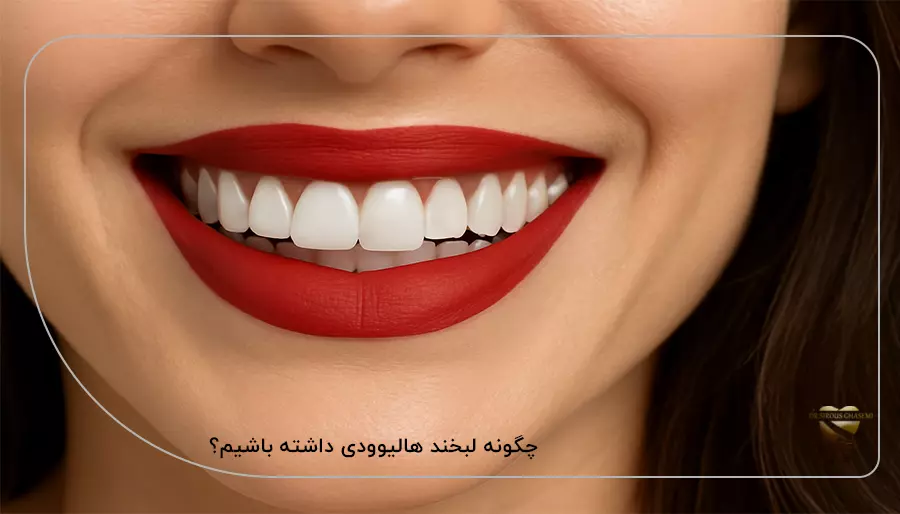 چگونه لبخند هالیوودی داشته باشیم؟