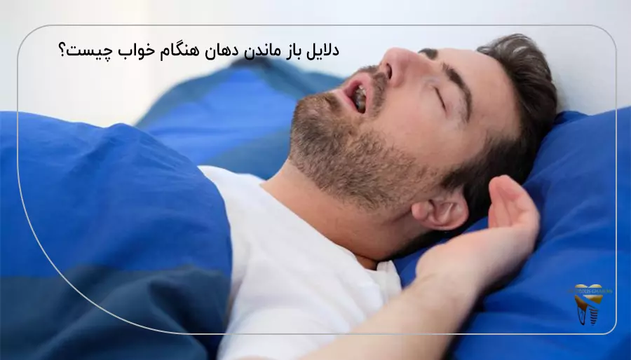 دلایل باز ماندن دهان هنگام خواب چیست؟