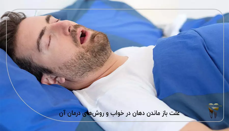 علت باز ماندن دهان در خواب و روش‌های درمان آن