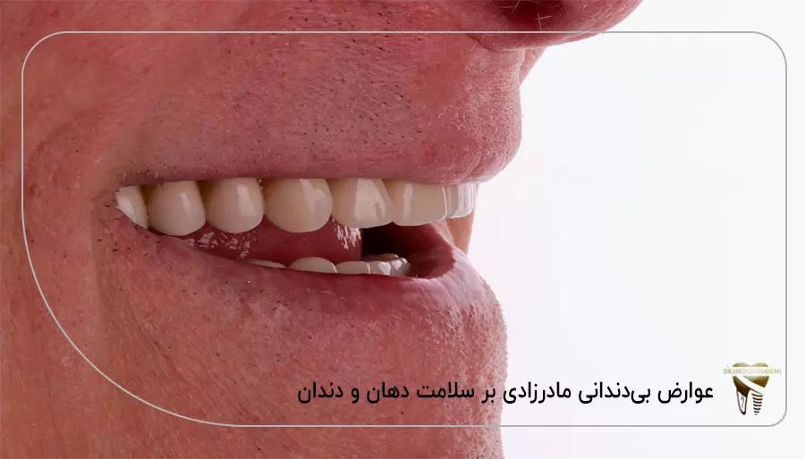 عوارض بی‌ دندانی مادر زادی بر سلامت دهان و دندان