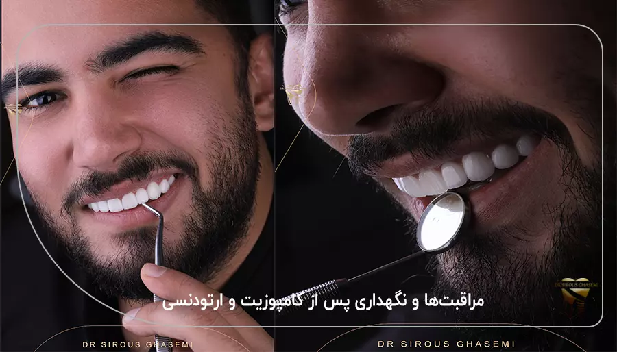 مراقبت‌ها و نگهداری پس از کامپوزیت و ارتودنسی