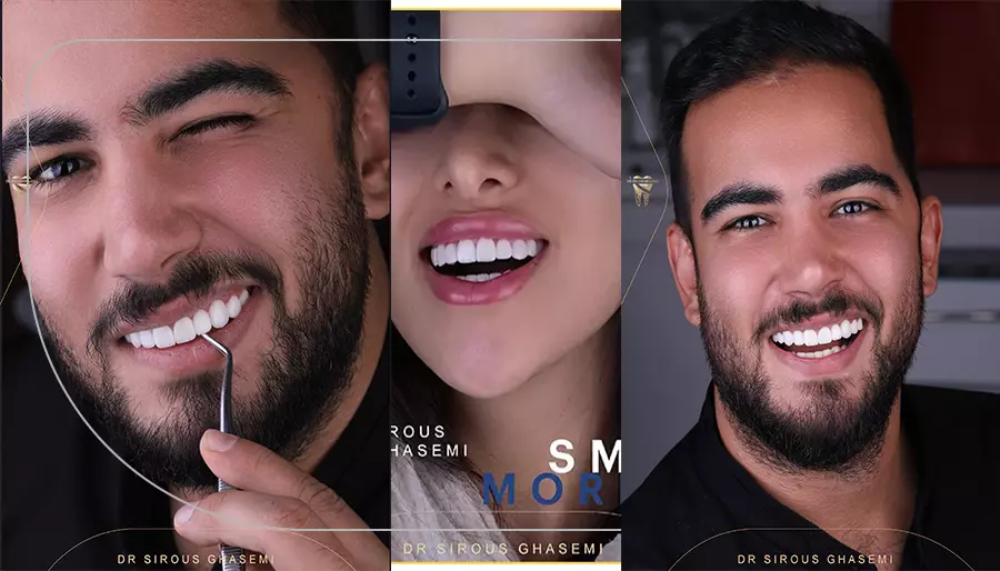 هزینه لمینت شیشه‌ ای
