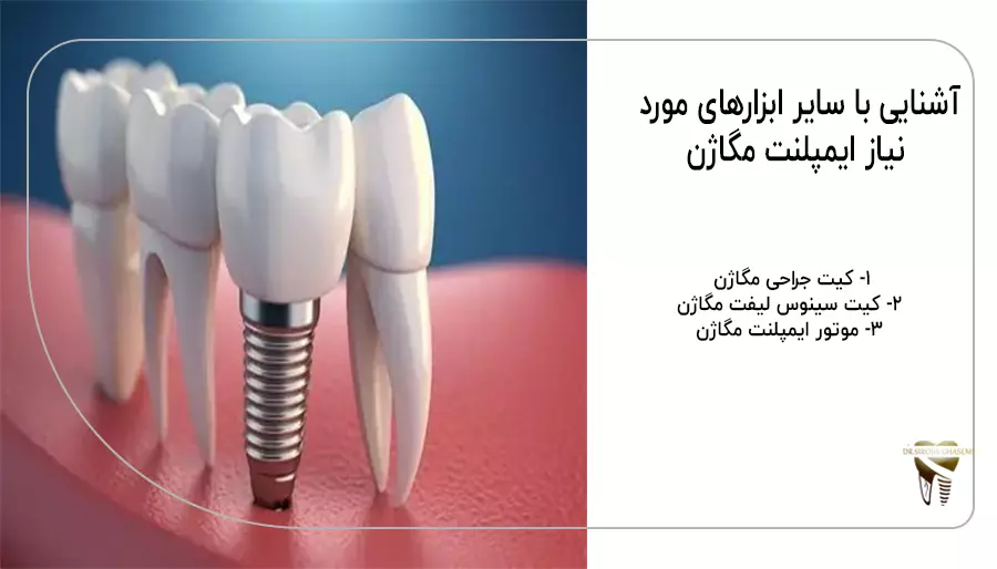 مزایا و معایب ایمپلنت مگاژن