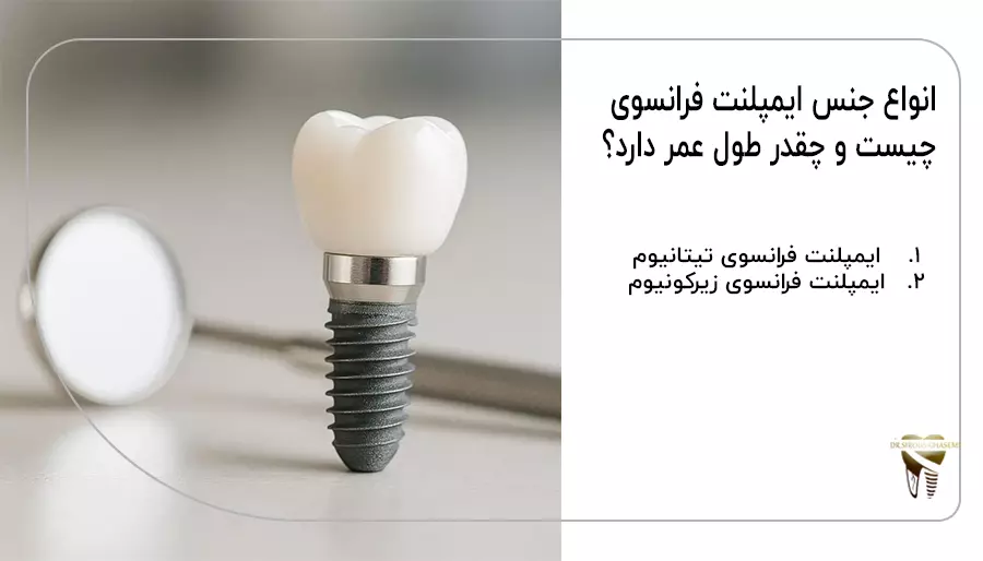 انواع جنس ایمپلنت فرانسوی