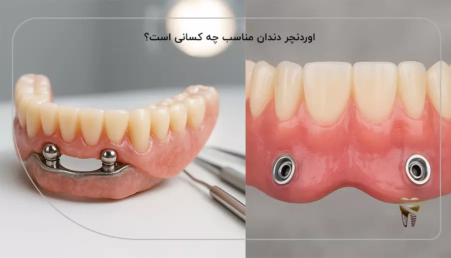 اوردنچر دندان مناسب چه کسانی است؟
