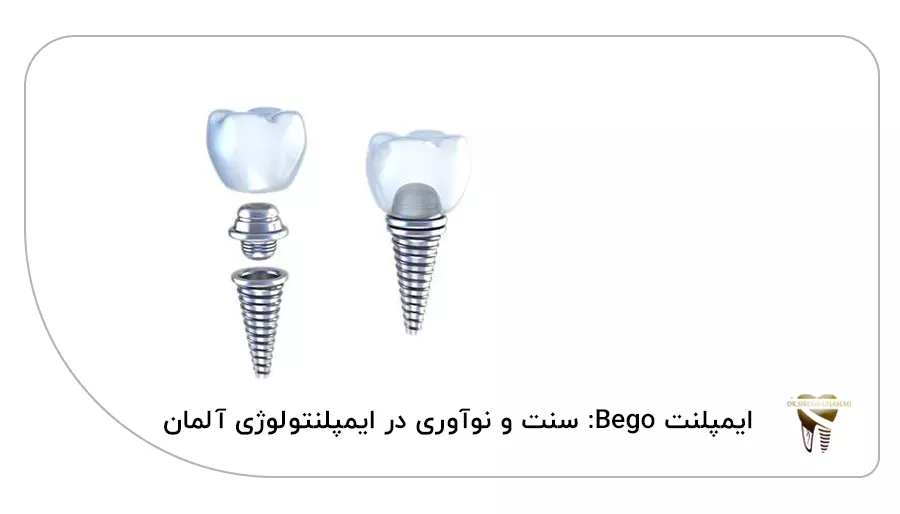 ایمپلنت Bego سنت و نوآوری در ایمپلنتولوژی آلمان