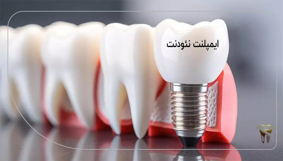 ایمپلنت نئودنت