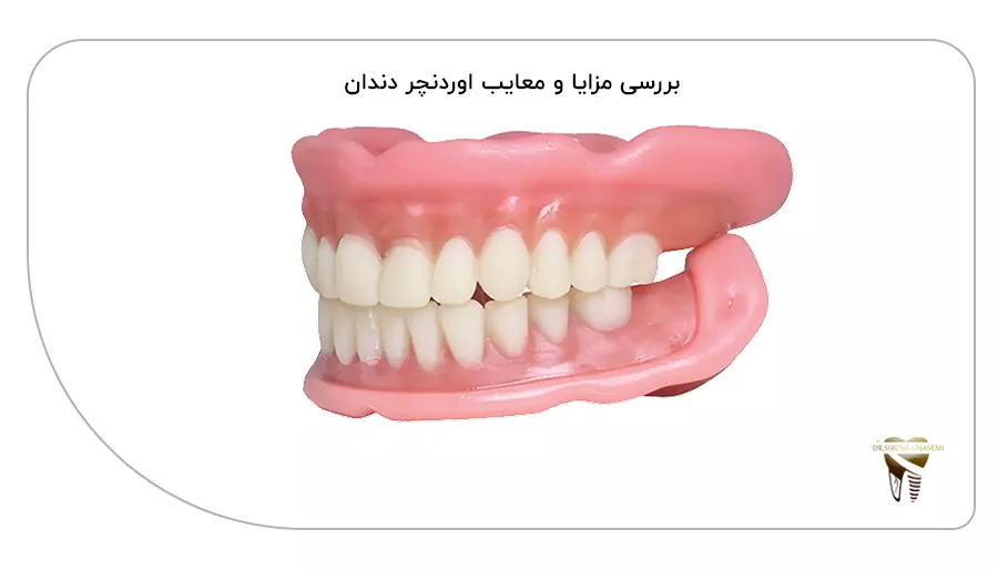 بررسی مزایا و معایب اوردنچر دندان