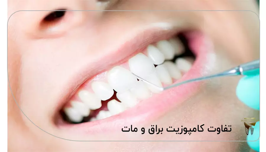 تفاوت کامپوزیت براق و مات
