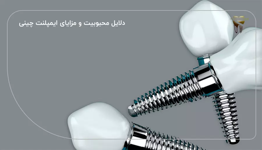 دلایل محبوبیت و مزایای ایمپلنت چینی