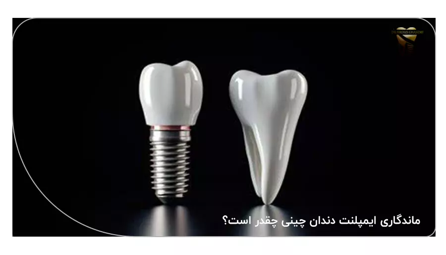 ماندگاری ایمپلنت دندان چینی چقدر است؟
