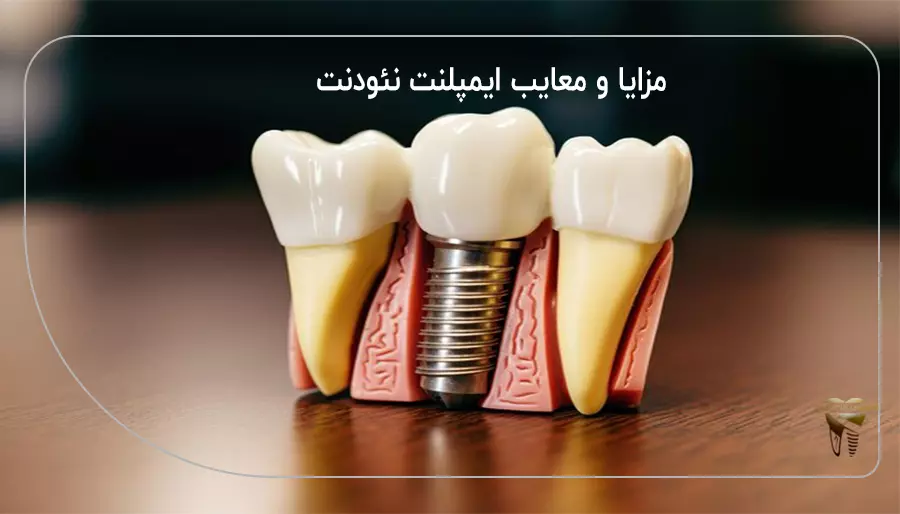 مزایا و معایب ایمپلنت نئودنت