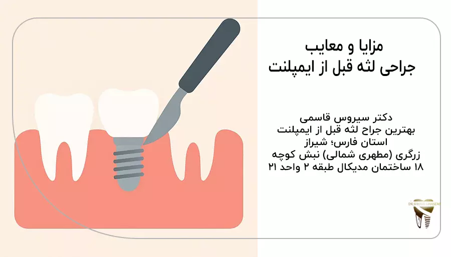 مزایا و معایب جراحی بثه قبل از ایمپلنت
