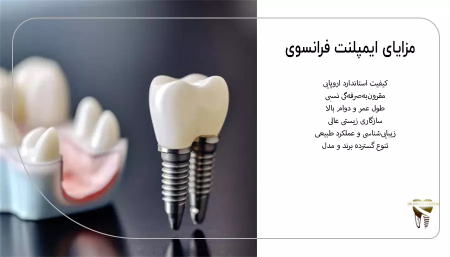 مزایای ایمپلنت فرانسوی