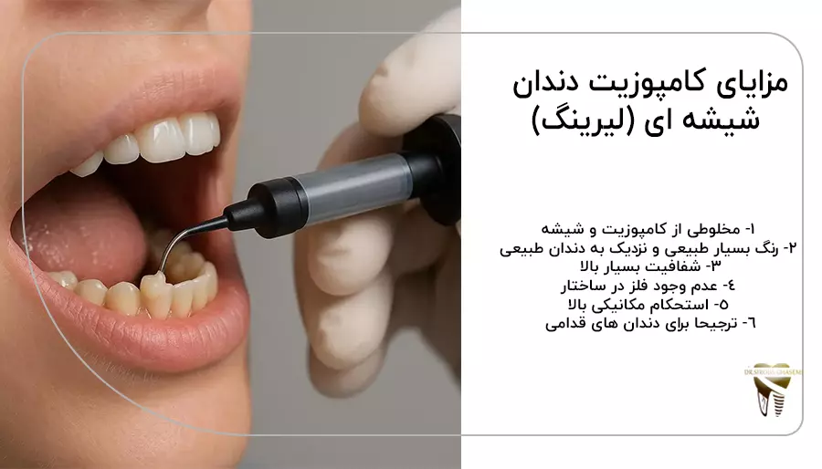 مزایای کامپوزیت دندان شیشه ای (لیرینگ)