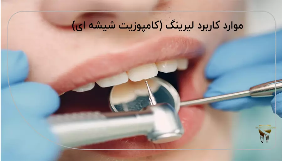 موارد کاربرد لیرینگ (کامپوزیت شیشه ای)