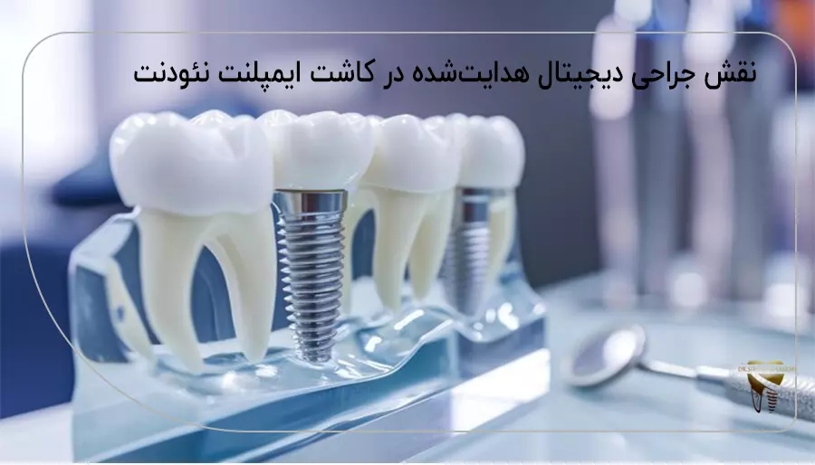 کاندیداری مناسب ایمپلنت نئودنت