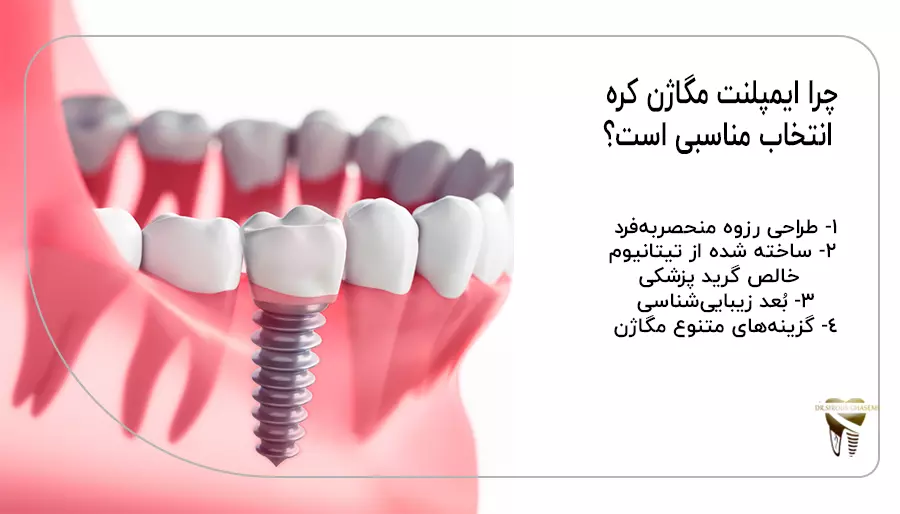 چرا ایمپلنت مگاژن کره