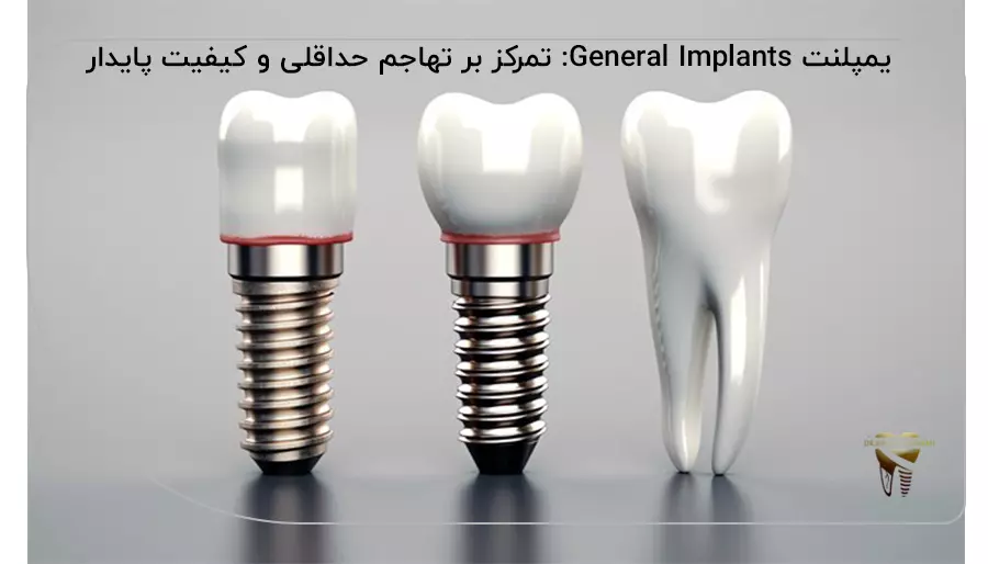 یمپلنت General Implants تمرکز بر تهاجم حداقلی و کیفیت پایدار
