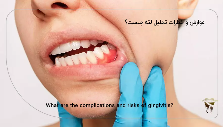 عوارض و خطرات تحلیل لثه چیست؟