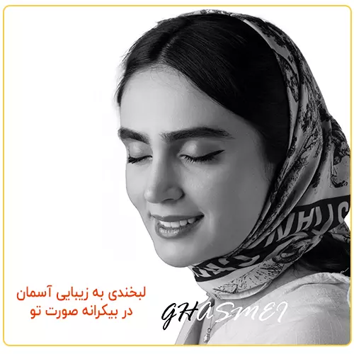 لمینت دندان شیراز اقساطی